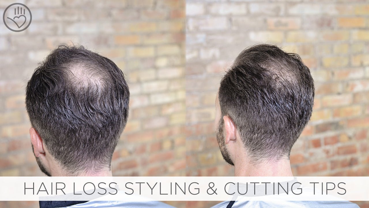 How To Cut &amp; Style Balding or Thinning Hair - Sam Villa